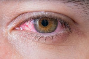 clínica oftalmológica Real Visión 6 hábitos realmente perjudiciales para tus ojos